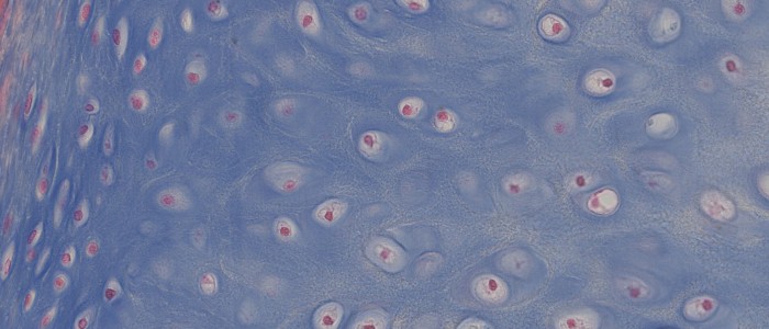 1_Cartil-2-bis-700x300