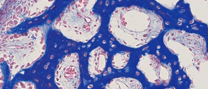 4_sld_2-700x300